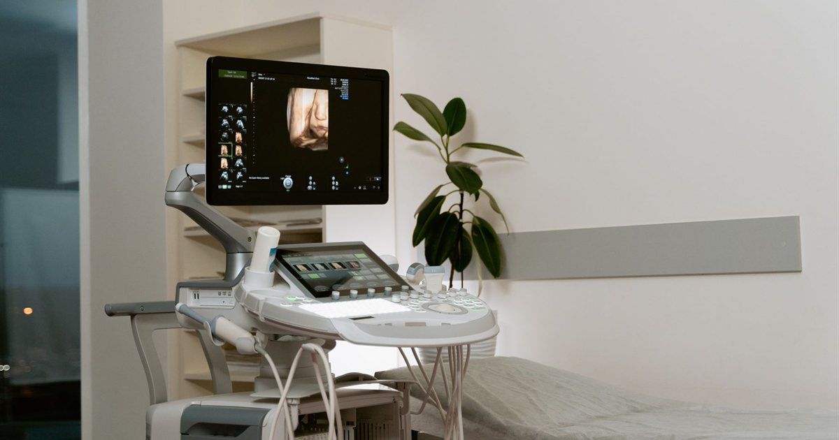 A modern ultrasound machine standing in a clinic examination room