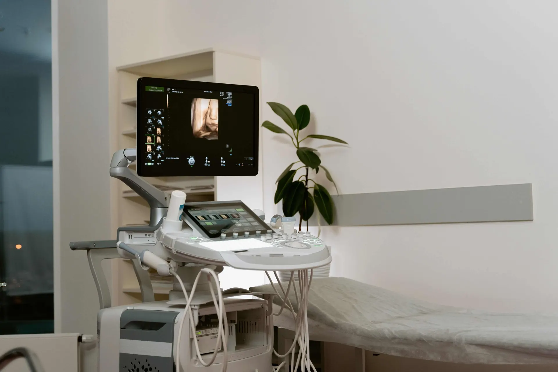 Ultrasound system set up in a clinical room